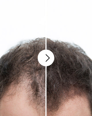 Capsule anticaduta con effetto infoltente e rinforzante Follixin 60 capsule - 6