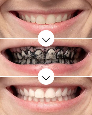 Polvere sbiancante per denti al carbone di cocco Smilebite