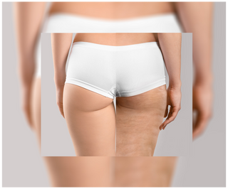 Compresse contro la cellulite e per il miglioramento della pelle con estratti naturali Cellinea 60 capsule - 6