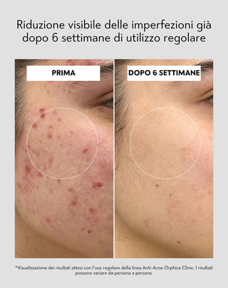 Peeling viso con niacinamide, pantenolo, BHA e microgranuli Anti-Acne Orphica Clinic 100 ml - 5