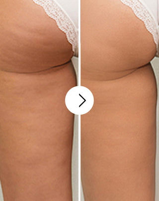 Compresse contro la cellulite e per il miglioramento della pelle con estratti naturali Cellinea 60 capsule - 3