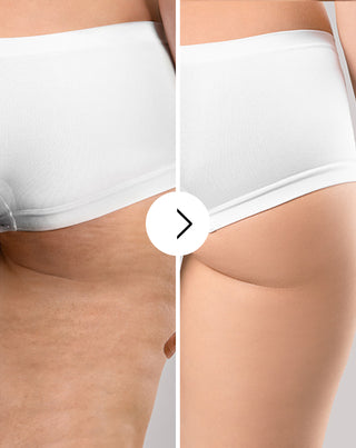 Compresse contro la cellulite e per il miglioramento della pelle con estratti naturali Cellinea 60 capsule - 4