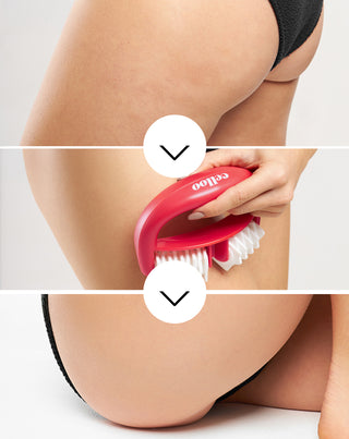 Massaggiatore anticellulite con sporgenze combatte la cellulite e riduce la tensione muscolare Crush my Celloo - 3