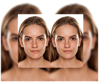 Pillole contro acne, brufoli e imperfezioni con zinco, vitamina C, E e B2 Derminax - 6