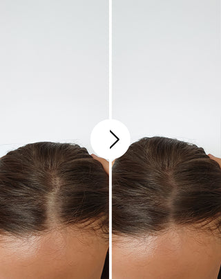 Capsule anticaduta con effetto infoltente e rinforzante Follixin 60 capsule