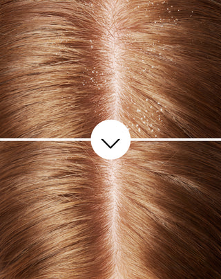 Shampoo antiforfora per capelli con olamina piroctone con azione idratante Nutridome