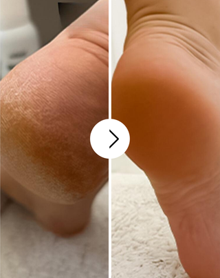 Crema piedi addolcente Nutridome con urea e burro di karité - 4