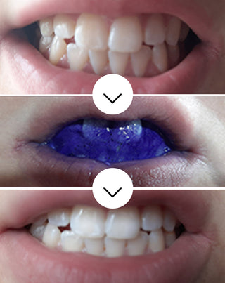 Correttore del colore – siero correttivo per il colore dei denti White Bite Smilebite 30 ml - 3